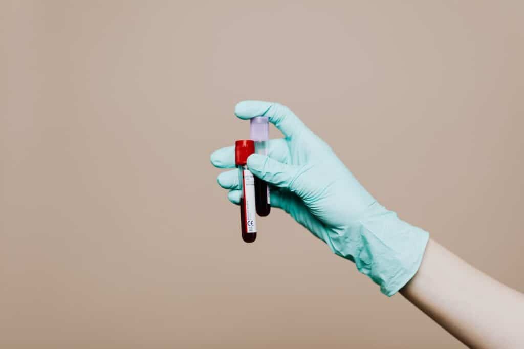 Picture of a doctor holding up two vials of blood for the blog post what is medical malpractice?